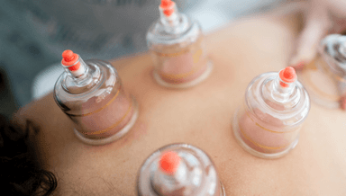 Image for Massage with Cupping